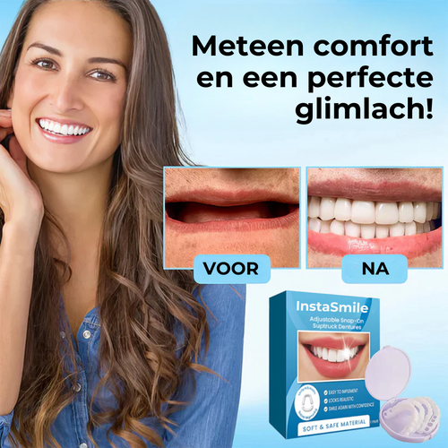 InstaSmile™ | Direct een perfecte glimlach