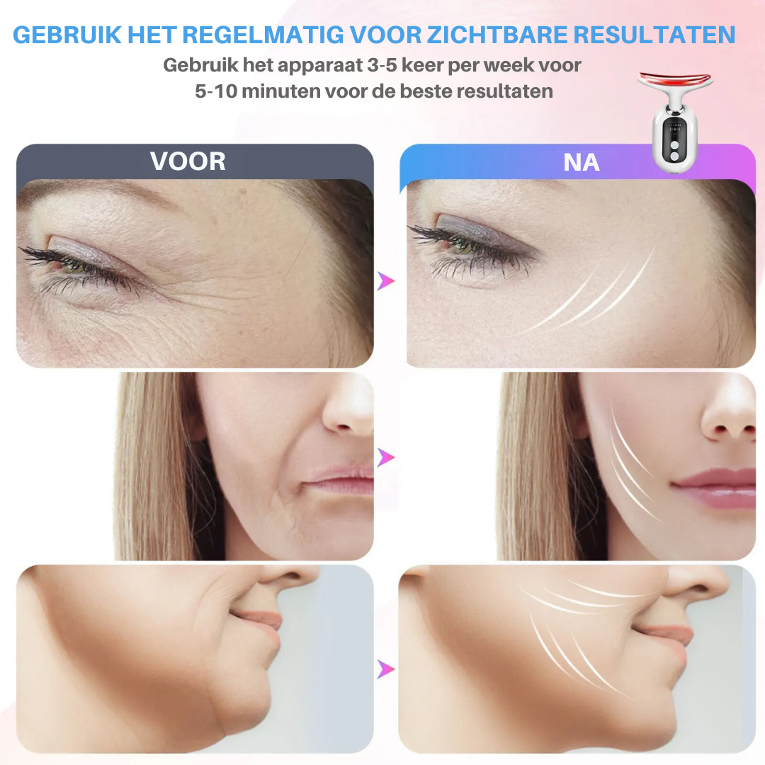 SkinLift Pro | Een strakkere en jongere huid