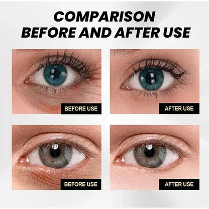 Cëlyn Instant EyeReviver